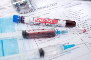 Blood samples with infected virus