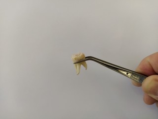 Removed tooth in tweezers on a white background © Alex Milan