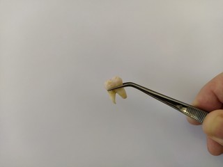 Removed tooth in tweezers on a white background © Alex Milan