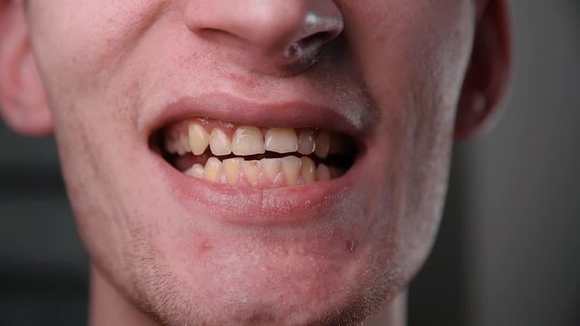 Man shows yellow teeth in bath. The guy is smiling. Front view. Close-up