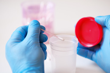 Global epidemic. Analysis. Test system for the diagnosis of coronavirus.