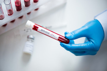 Close-up of test tube with a blood test and a coronavirus vaccine in hands of doctor. Concept of...