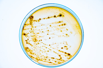 Growing Bacteria in Petri Dishes on agar gel Scientific experiment.