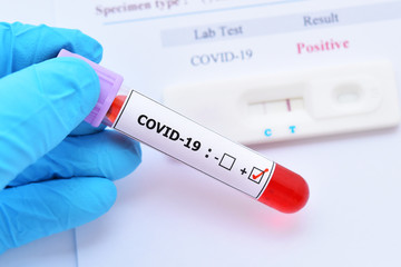 Obraz premium Positive test result by using rapid test device for COVID-19 virus, novel coronavirus 2019 found in Wuhan, China
