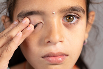 Extreme close up of child rubbing her eyes - concept showing to prevent and Avoid touching your eyes. Protect from COVID-19 or coronavirus infection or outbreak - Don t Touch Your eyes.