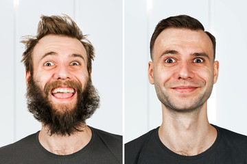 happy guy with beard and without hair loss. Man before and after shave or transplant. haircut set transformation.