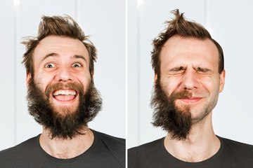 happy guy with half beard and without hair loss. Man before and after shave or transplant. haircut...