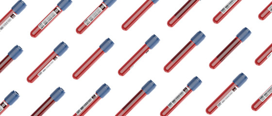 Blood test vials with covid19 virus, testing for coronavirus concept