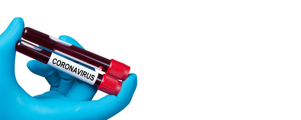 Coronavirus 2019-nCoV Blood Sample.