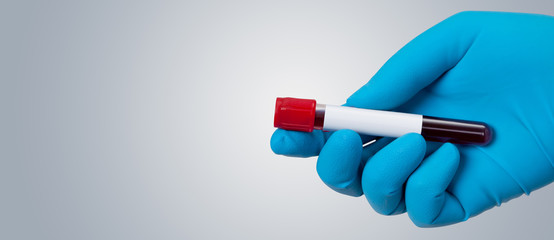 Coronavirus 2019-nCoV Blood Sample.