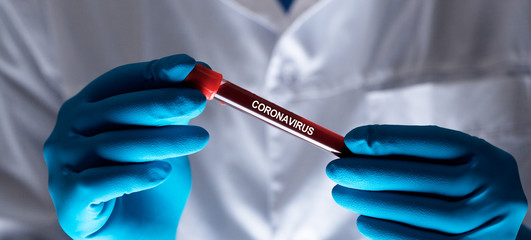 Coronavirus 2019-nCoV Blood Sample.