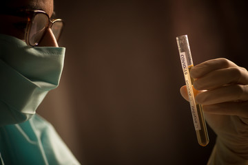 Doctor holding a coronavirus COVID-19 test tube