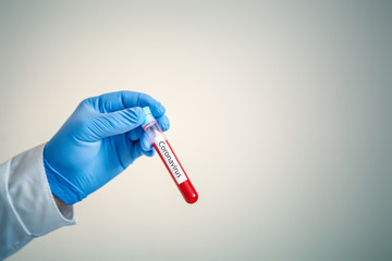 Corona Virus in Lab. Scientist hold Blood Test. New Epidemic Coronavirus 2019 nCoV. Background with copy space. Horizontal.