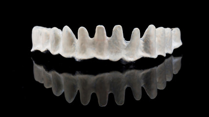 titanium beam with apak material on the lower jaw of the patient, shot on a black mirror with reflection