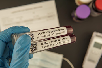 Hand holding test tube blood sample