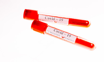 Positive blood Tests for Coronavirus in test tubes.