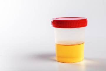 Plastic container with urine analysis on white background