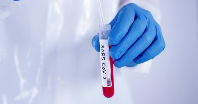 Medical lab worker with blue surgical gloves holding blood samples tube taking blood for testing coronavirus Covid-19 (2019-nCoV) shot in 4k super slow motion