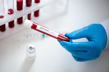 Obraz premium Close-up of test tube with a blood test and a coronavirus vaccine in hands of doctor. Concept of vaccination, Covid-19 diagnostic, cure for flu virus