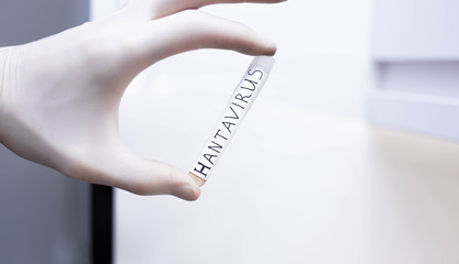 study of hantavirus in a medical test tube; vaccine development. The disease is transmitted by...