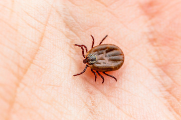 Encephalitis Insect Tick Crawling on Skin. Encephalitis Virus or Lyme Borreliosis Disease Infectious Dermacentor Tick Arachnid Parasite Macro.