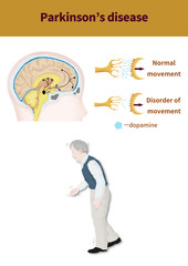 medical illustration for explain diseases