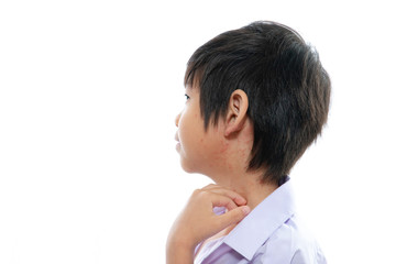 asian boy screatching his neck with rash on white background isolated