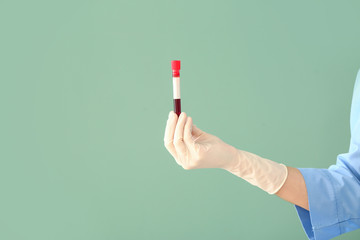 Doctor's hand holding test tube with blood sample on color background