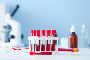 Test tubes with blood samples on table in laboratory