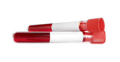 Test tubes with blood samples on white background