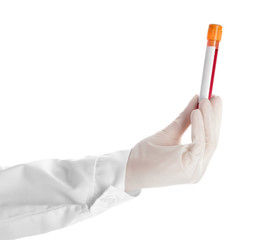Doctor's hand holding test tube with blood sample on white background