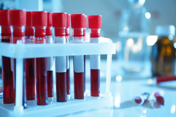Test tubes with blood samples on table in laboratory, closeup