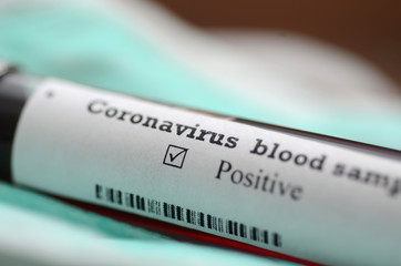 Obraz premium Coronavirus 2019-nCoV Blood Sample . Epidemic virus Respiratory Syndrome stock photo. Test tube with Blood Test (novel Coronavirus 2019 disease,COVID-19,nCoV)