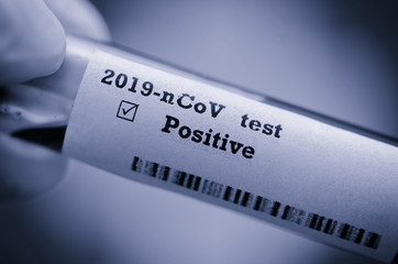 Obraz premium Stock photo of holding tube with Blood Test (novel Coronavirus 2019 disease,COVID-19,nCoV) and Flag of Switzerland. Switzerland virus outbreak.
