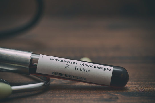 Coronavirus 2019-nCoV Blood Sample . Epidemic virus Respiratory Syndrome stock photo. Test tube with Blood Test (novel Coronavirus 2019 disease,COVID-19,nCoV)