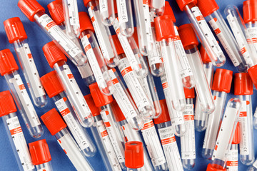 Blood tubes in tray in the laboratory. Rack of blood tubes test for analysis in the laboratory of hematology. COVID-19 and coronavirus identification.
