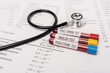 Close up view of test tubes with hormone and insulin tests of blood near stethoscope and lists with...