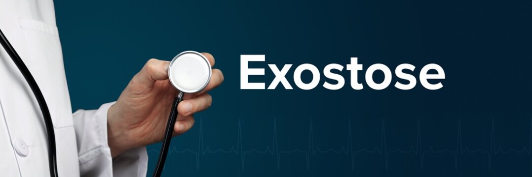 Exostose. Arzt im Kittel h&auml;lt Stethoskop. Das Wort Exostose steht daneben. Symbol f&uuml;r Medizin, Krankheit, Gesundheit