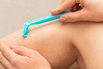 Foliculitis on hairy skin - shaving