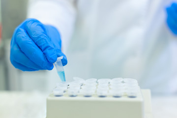 Laboratory worker puts samples into a tray making analysis for immunity viruses in a medical laboratory. COVID-19. COVID Coronavirus