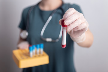 Doctor nurse holding vial tube with blood test result with copy space