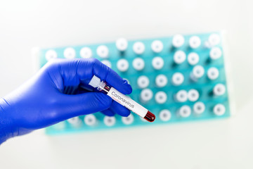 Health worker holds one test-tube indicating positive results of corona virus test. Many blood tube-tests  as a background.