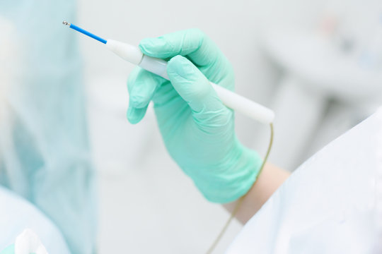 doctor dermatologist hold a radio wave knife to remove pigmentation, moles, warts, seborrhea, rosacea. Prevention of melanoma