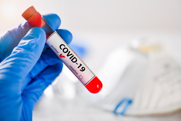 Doctor holding a positive blood test result  in blue gloves. Coronavirus or covid-19 epidemic