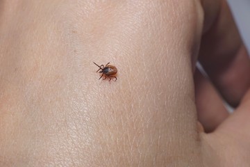 Female tick ( Ixodes scapularis) crawling on skin ready to bite 