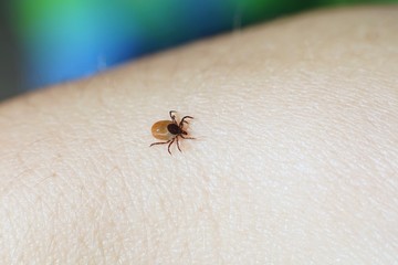 Female tick ( Ixodes scapularis) crawling on skin ready to bite 