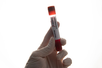 coronavirus blood test sample tube on hand isolated