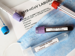 Coronavirus COVID-2019 test concept