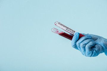 Obraz premium cropped view of scientist in latex glove holding test tubes with blood samples isolated on blue