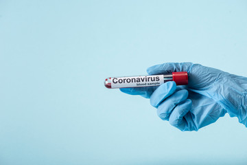 Obraz premium cropped view of scientist in latex glove holding test tube with blood sample isolated on blue